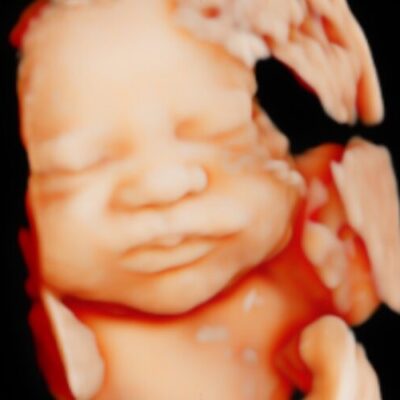 UC Baby HD Ultrasound