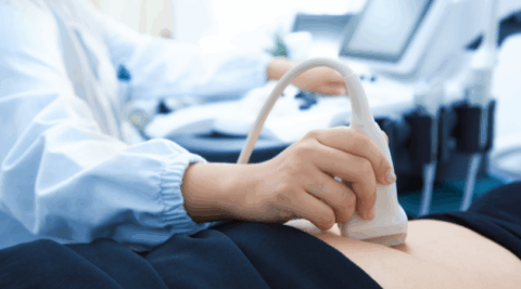UC Baby Blog - FAQ 20-Week Anatomy Scan